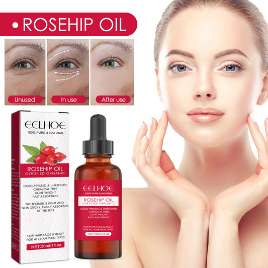 Rosehip Facial Oil For Facial And Smooth Hair Care